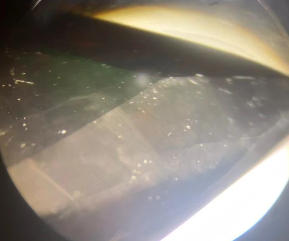 Qualité de la taille 